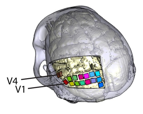 Cerebro de uno de los animales con la localización de las 16 matrices de microelectrodos./CIBER.
