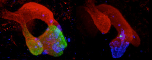 Diferencias en el desarrollo de páncreas de ratón. Crédito: Miguel Angel Maestro/CRG/Developmental Cell.