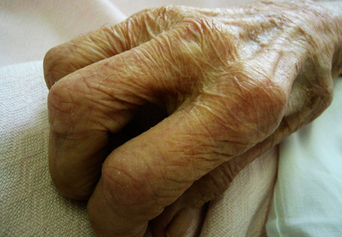 El alzhéimer y el párkinson podrían detectarse en la piel. Foto: Sarchi