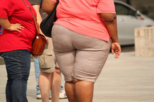 Obesidad. Foto: UGR.