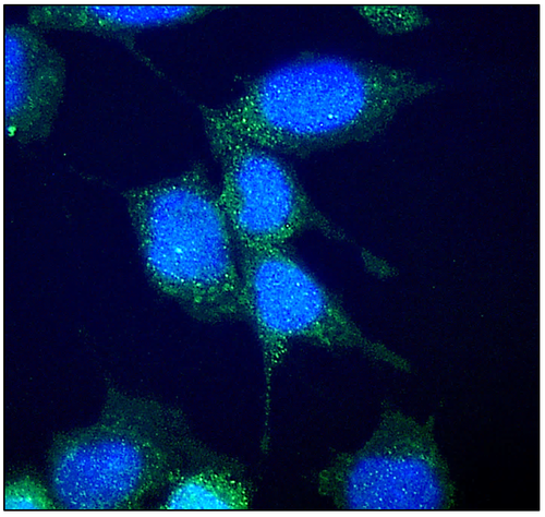Cultivo celular de astrocitos. El núcleo celular está marcado en fluorescencia azul, mientras que ApoD aparece en fluorescencia verde/Diez-Hermano et al. 2020