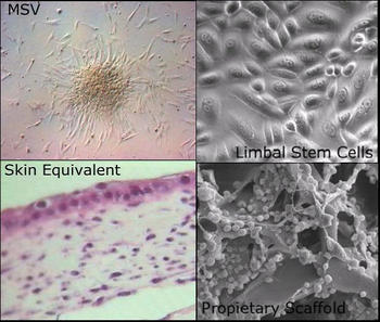 La terapia celular propuesta mejora la calidad del cartílago articular en la mayoría de los casos (11 de 12). 