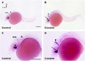 Diferencias en el desarrollo de los embriones de pez cebra expuestos a cocaína (derecha) y un grupo de control. Imagen: Roger López.