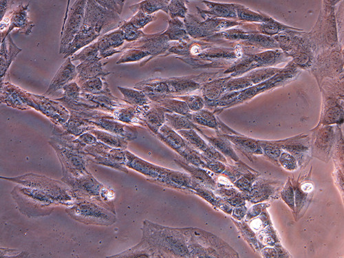 Imágenes microscópicas de células del músculo. Créditos: Gentileza de la Dra. Claudia Hereñu