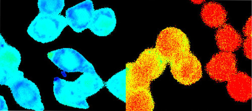 Células normales (izquierda) y células tumorales (derecha), el rojo indica una mayor cantidad de calcio. FOTO: CSIC
