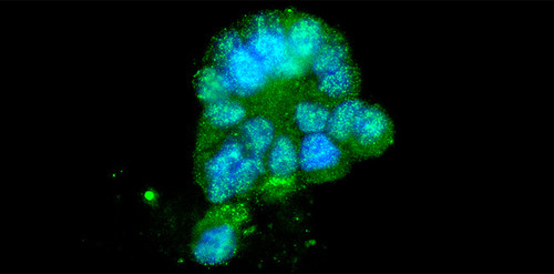 En la imagen, capturada por un microscopio de fluorescencia, puede observarse una célula infectada por enterovirus. Los puntos verdes corresponden a los anticuerpos adheridos al virus. Fotografía: gentileza del equipo de investigación.