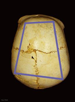 El Cráneo 14, de la Sima de los Huesos de Atapuerca, apodado Benjamín.