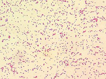 Bacteria causante de la brucelosis.