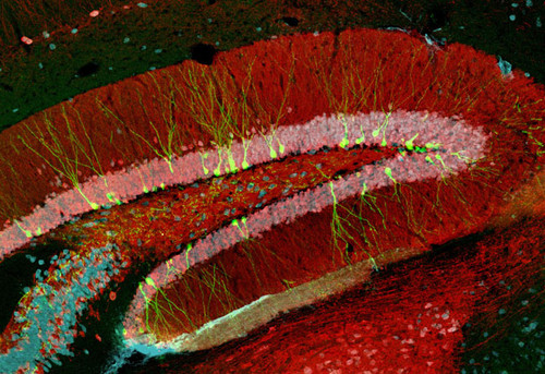 Imagen obtenida por microscopía confocal, correspondiente a un corte de hipocampo de ratones adultos.  Créditos: Lic. M. Georgina Davies-Sala.