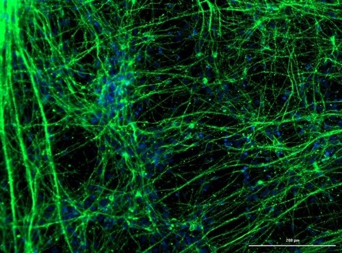 Neuronas derivadas de células madre neurales/Giuliana S. Zuccoli
