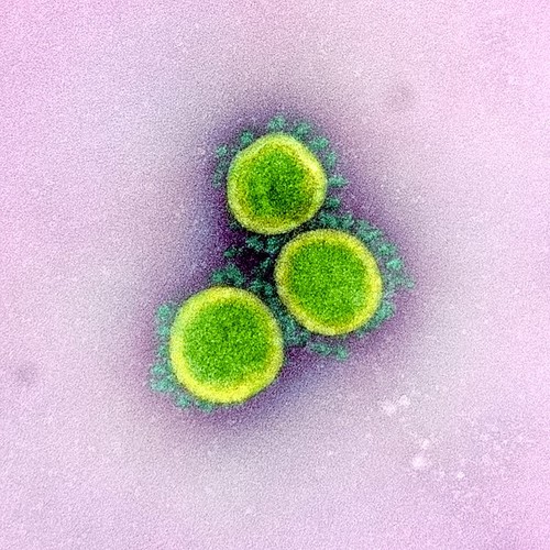 Micrografía electrónica de transmisión de viriones de SARS-CoV-2 aislados desde un paciente y coloreada para resaltar los virus. National Institute of Allergy and Infectious Diseases (NIAID) / CC BY (https://creativecommons.org/licenses/by/2.0)