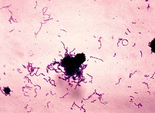 Streptococcus mutans.