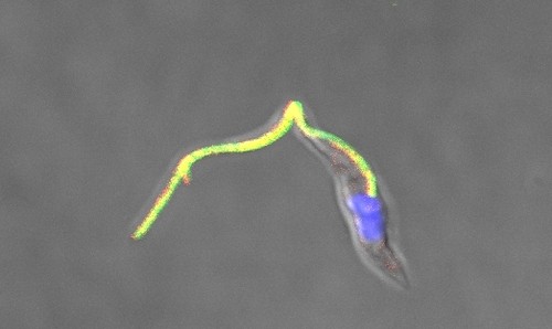 Trypanosoma cruzi. (imagen: Noelia Lander)