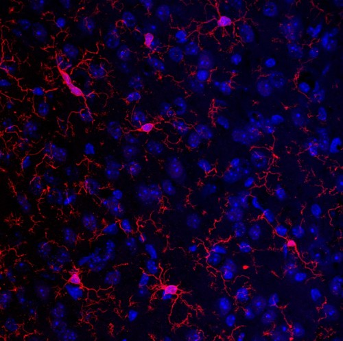 Células de la glía que participan en la respuesta inmune en cerebro. Imagen: Neurobiología Molecular IBSAL.
