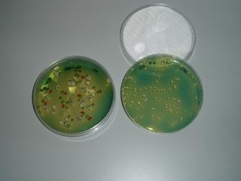 Placas con cultivos de levaduras vínicas empleadas en los laboratorios de Inbiotec