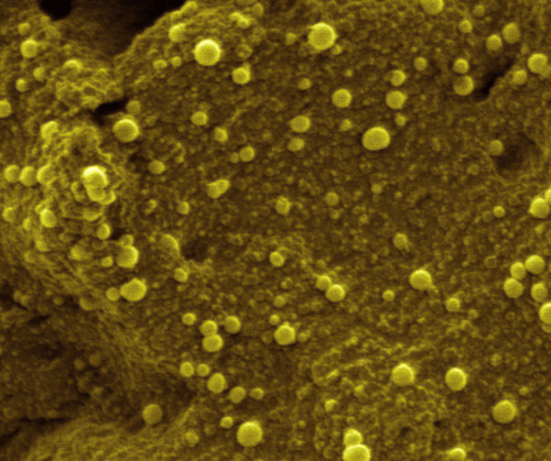 Nanopartículas metálicas depositadas sobre un polímero conductor (Fotografía: Universidad de Burgos)