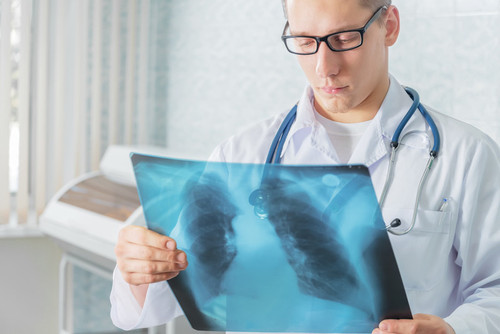 Un médico mira una radiografía de un paciente de tuberculosis. /Fotolia