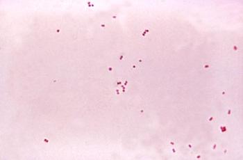 'Neisseria meningitidis'. Foto: Wikipedia.