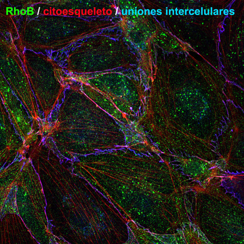 Endotelio con la proteína RhoB (verde), citoesqueleto (rojo) y las uniones intracelulares (azul). Imagen: CSIC.