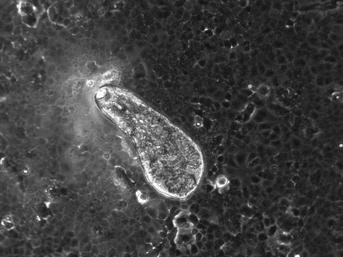 Imagen de microscopio del gusano parásito ‘Fasciola hepatica’. / IRNASA-CSIC..