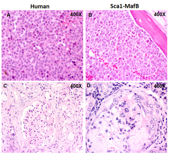 Arriba, imágenes de mieloma múltiple en paciente (izquierda) y ratón (derecha). Abajo, daño renal en ambos. Imágenes: Carolina Vicente Dueñas.