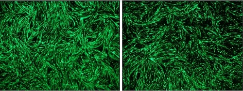 Células musculares tratadas con medio condicionado de células tumorales. El modelo in vitro de caquexia del cáncer se utilizó en las últimas etapas del estudio/Archivo de los investigadores.