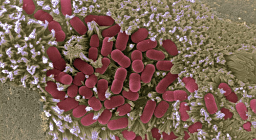 Imagen microscópica de la mucosa intestinal afectada por E.coli./ CNB-CSIC.