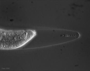 Gusano nematodo 'Caenorhabditis elegans' (Foto: CSIC).