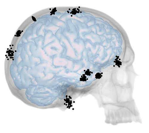 Un nuevo trabajo profundiza en la integración anatómica entre cráneo y cerebro en los humanos modernos/Bruner et al.
