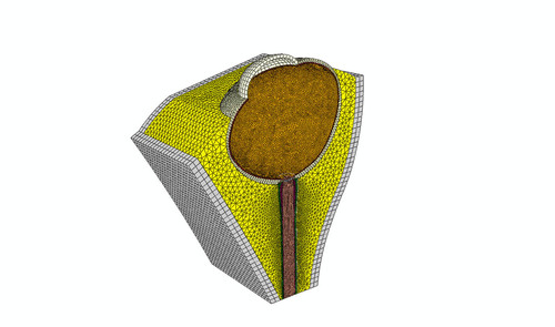 En el modelo 3D se incluyeron cada uno de los tejidos del ojo humano para hacer una simulación. Foto: Juan David Alarcón Castiblanco, magíster en Ingeniería Mecánica de la Facultad de Ingeniería de la UNAL.