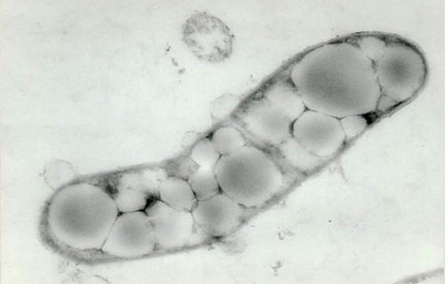 Bacterias del género Rhodococcus. Foto: gentileza investigador.