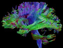 Imagen de cerebro generada a partir de resonancia magnÃ©tica. Imagen: UC3M.
