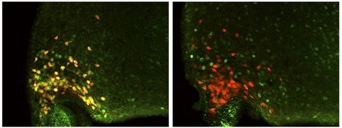 A la derecha, neuronas AgRP de animales nocaut para el receptor de GH; a la izquierda, neuronas de animales de control/Nature Communications