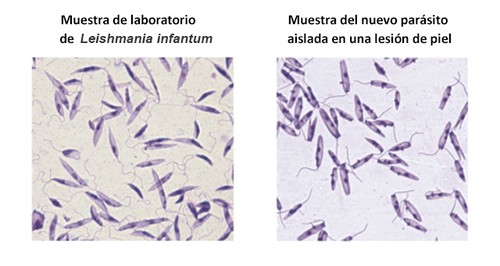 Descubren una nueva especie de parásito capaz de causar una enfermedad similar a la leishmaniasis visceral/Roque Pacheco Almeida
