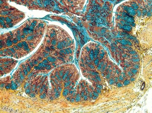 Imagen de un corte del intestino de un ratón afectado con enfermedad inflamatoria intestinal / CSIC.