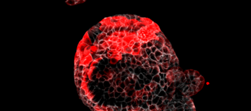 Organoide de cáncer colorrectal con células residuales responsables de la recaída marcadas en rojo./CIBER.