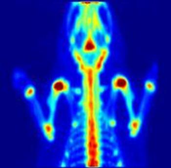 Tomografía por emisión de positrones de un ratón