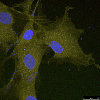 Imágenes de microscopio de los materiales que componen estas prótesis avanzadas (FOTO: GIR Neurobiología). 