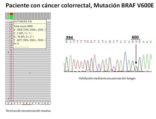 Mutación de BRAF en un paciente con cáncer colorrectal.