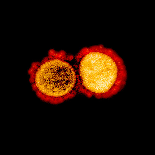 Micrografía electrónica de transmisión del virus SARS-CoV-2, aisladas de un paciente. Imagen capturada y mejorada en color en la Instalación de Investigación Integrada (IRF) del NIAID en Fort Detrick, Maryland/NIAID