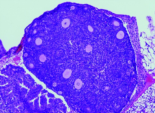Reducción en el número de folículos ováricos (causante de la insuficiencia ovárica prematura) en los ratones con la variante humanizada en FOXL2. / Centro de Investigación del Cáncer (CSIC-USAL).