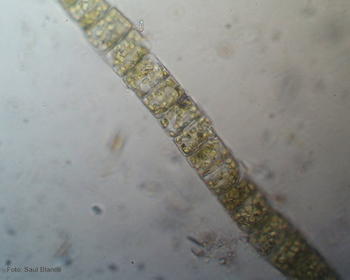 Colonia filamentosa de la diatomea 'Melosira varians'.