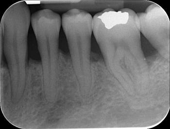 Paciente con enfermedad periodontal (FOTO: Javier Núñez).