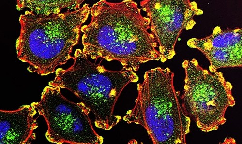 Células de melanoma/Julio Valencia – National Cancer Institute
