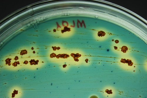 Producción de sideróforos secretados por la bacteria Micromonospora. Foto: Martha Trujillo.