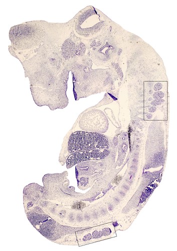 Sección de un embrión de ratón en el que se aprecian ganglios raquídeos (rectángulos).