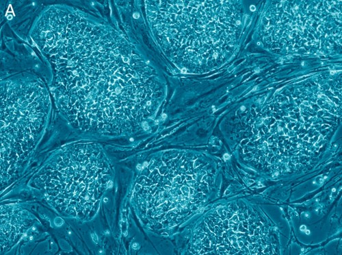 Células madre cancerosas. FOTO: Wikimedia