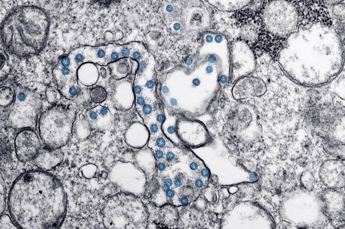 Partículas del virus SARS-CoV-2, coloreadas en azul, en una imagen de microscopio de electrones. / CDC.