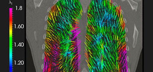 Plataforma digital que simula y analiza la deformidad pulmonar. FOTO: UC.