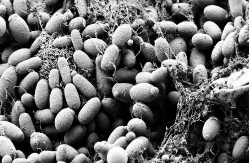 Imagen de la bacteria probiótica 'Streptococcus thermophilus' CRL1190, cepa que podría anular o limitar el rol patógeno de otro microorganismo, Helicobacter pylori, causante de gastritis y úlceras/Agencia CYTA